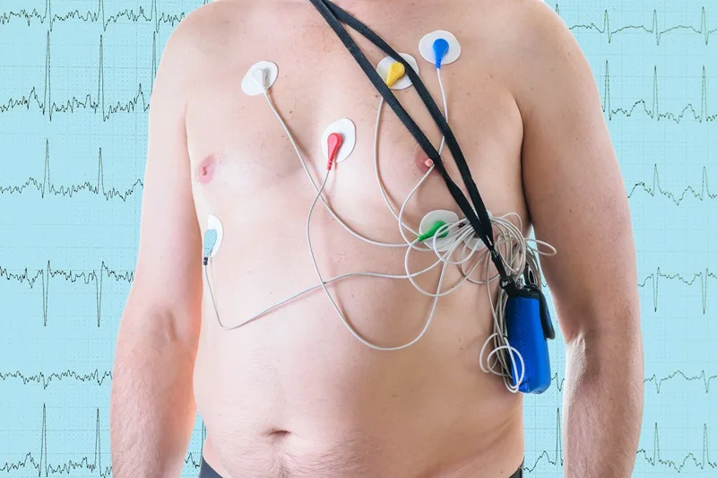 Holter de 24 horas