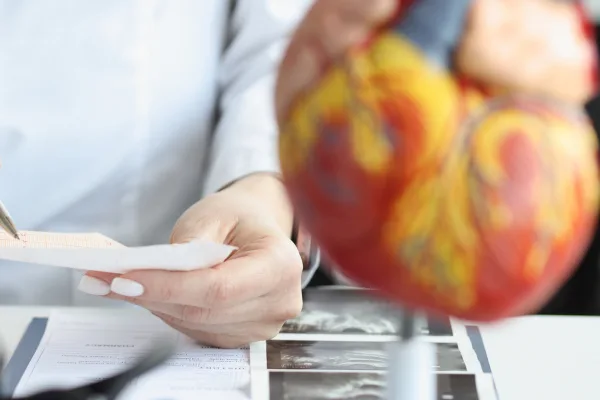 ¿Qué médico trata colesterol elevado?